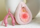 Für Schulungen: Anatomiemodelle für Vulva & Klitoris Anatomiemodelle Vulva und Klitoris bei Amazon